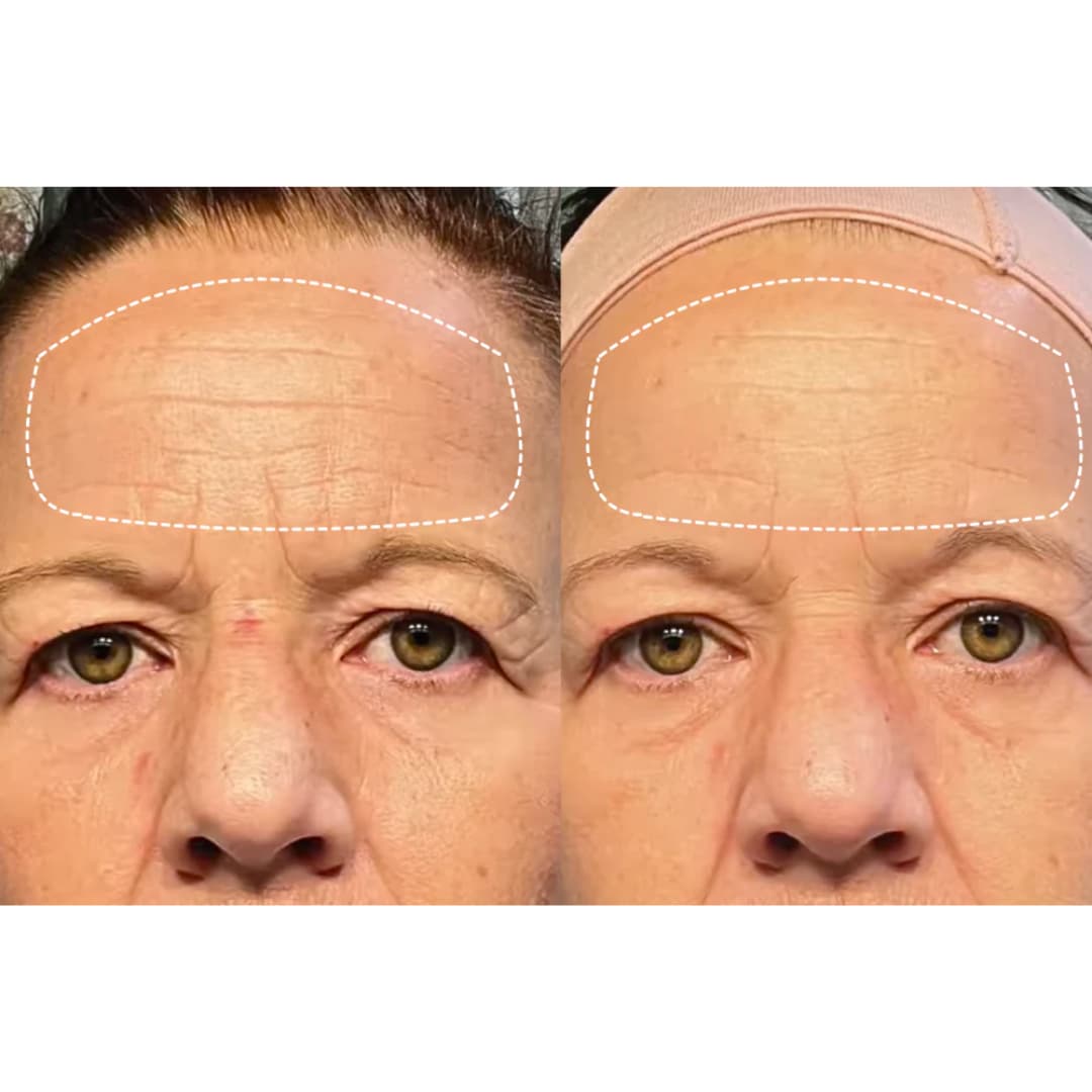 Velana Face Mask Pro