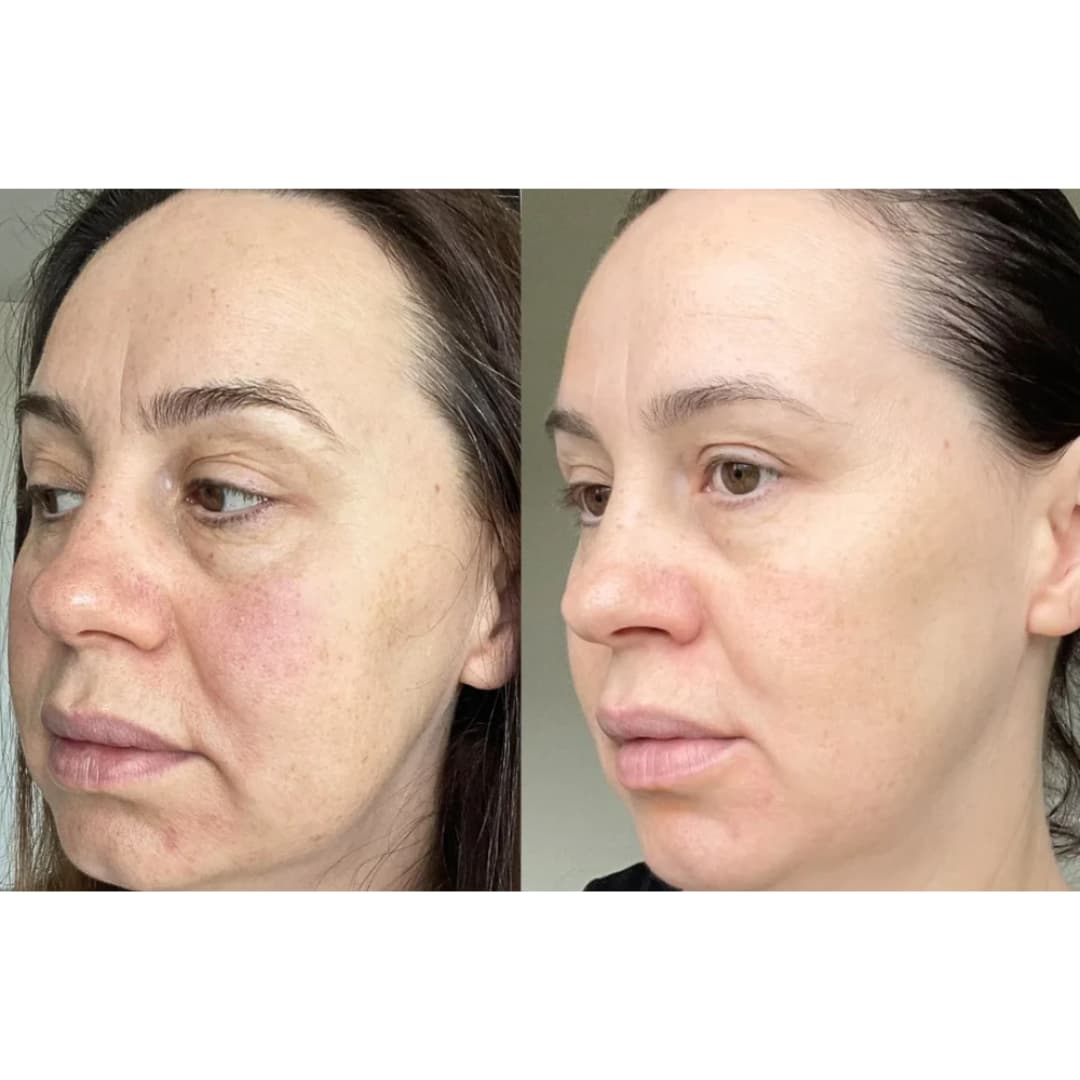 Velana Face Mask Pro