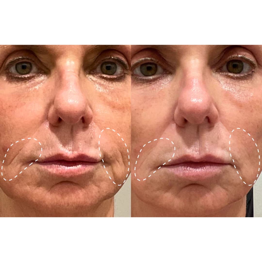 Velana Face Mask Pro