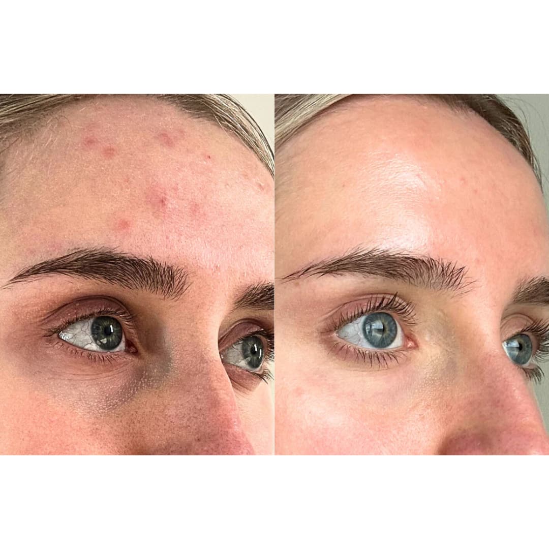 Velana Face Mask Pro