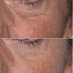 Velana Face Mask Pro