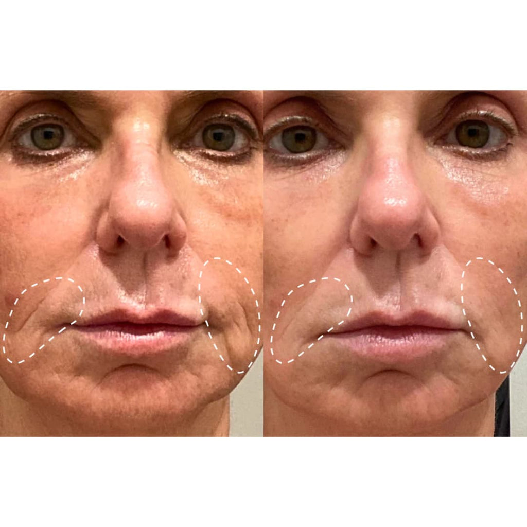 Velana Face Mask Pro