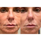 Velana Face Mask Pro